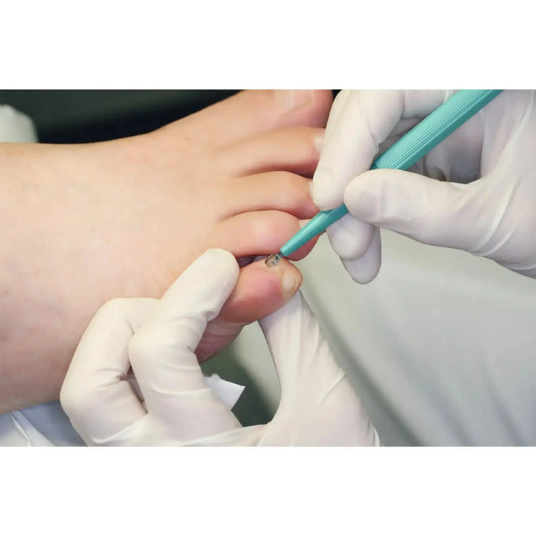 Huidcurette - Lengte: 15 cm - Ruck Ruck 