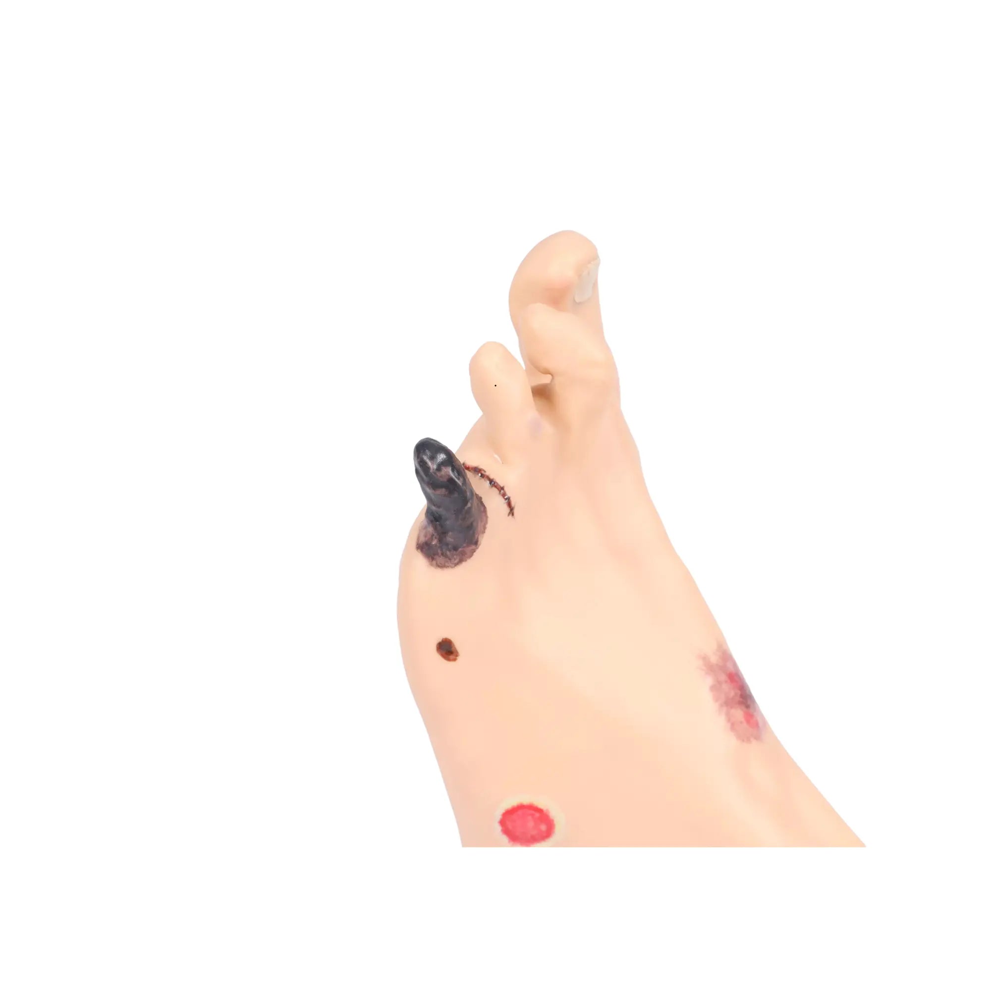 Voetmodel met wonden - Anatomie en pathologie Mijn Podotherapie 