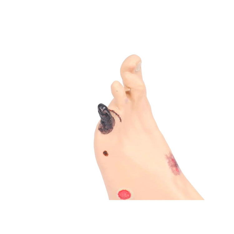 Voetmodel met wonden - Anatomie en pathologie Mijn Podotherapie 