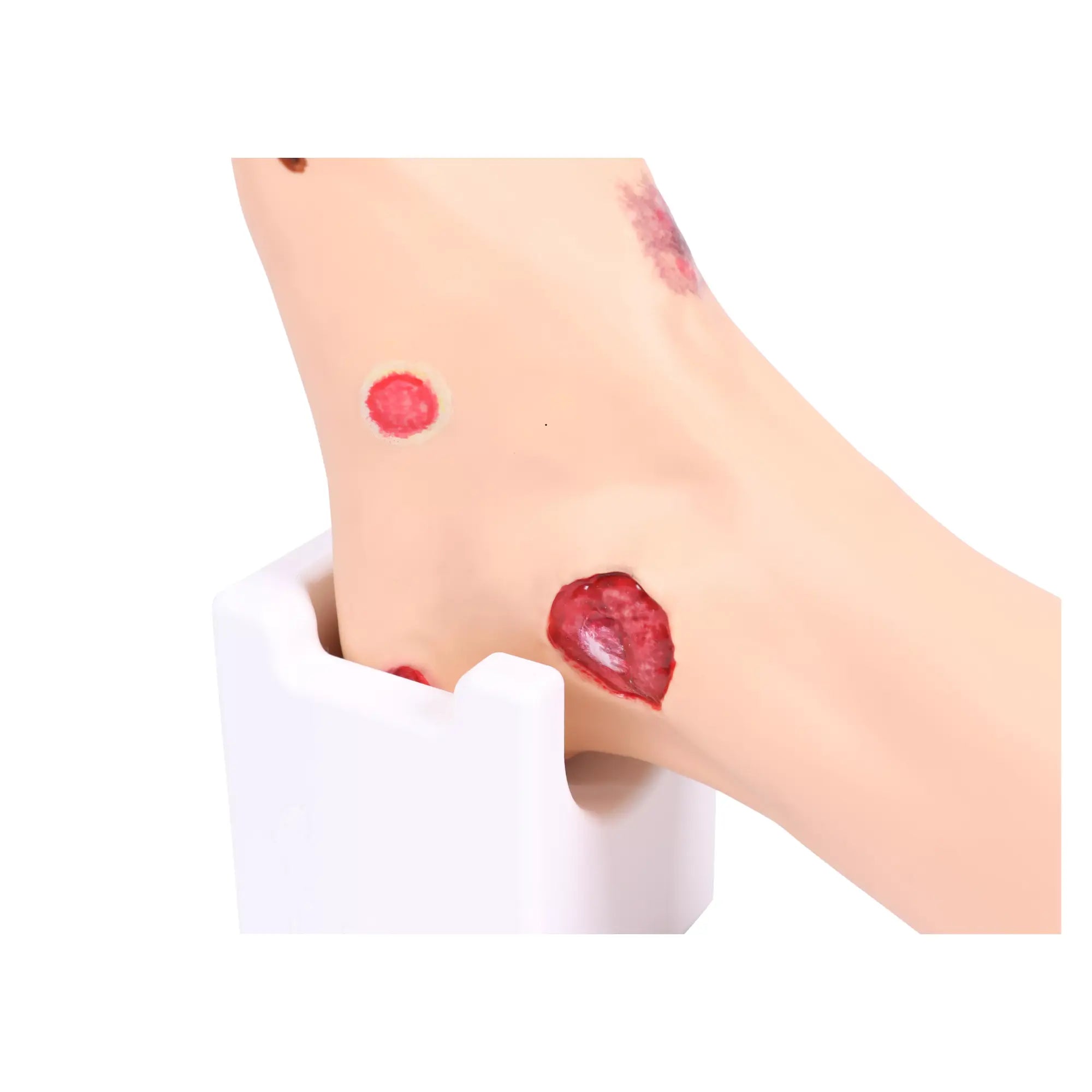 Voetmodel met wonden - Anatomie en pathologie Mijn Podotherapie 