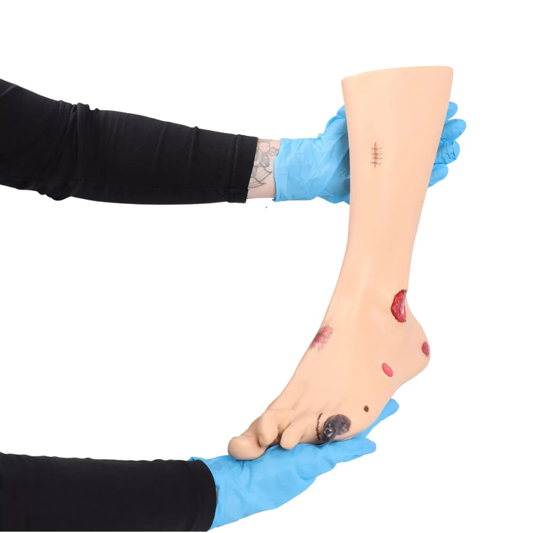 Voetmodel met wonden - Anatomie en pathologie Mijn Podotherapie 