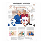 Anatomisch bord - Ziekte van Alzheimer - Anatomie en pathologie