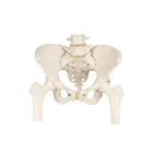 Bekkenskelet, vrouwelijk, met dijbeenstompen - Anatomie en pathologie