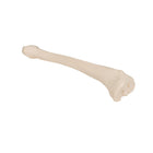 Tibia - Anatomie en pathologie